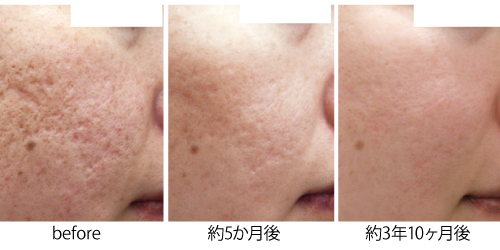 リスクは何ですか?