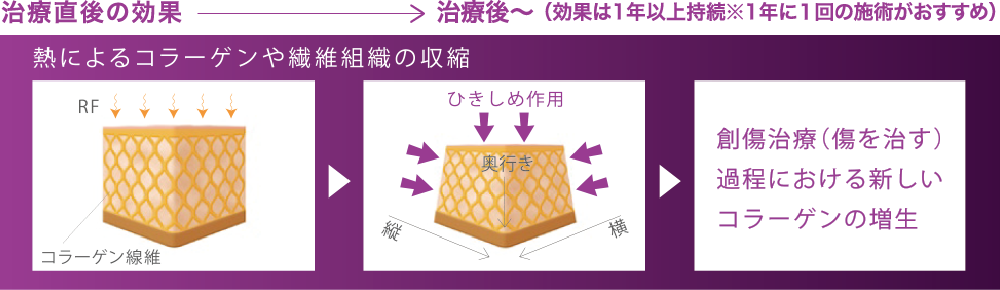 大量のコラーゲンが生成、活性化