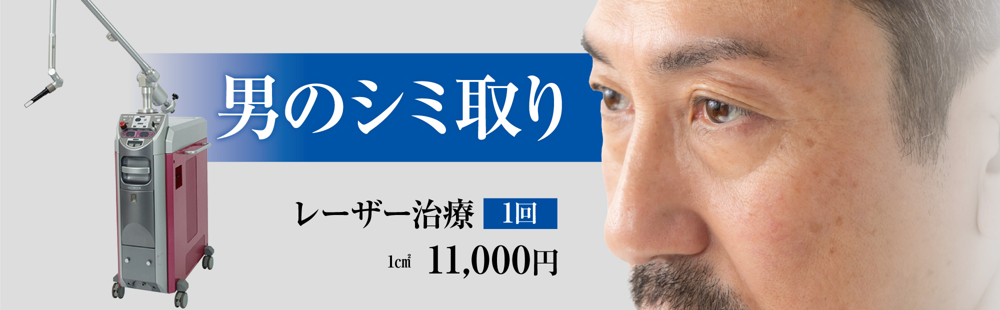 男のシミ取り