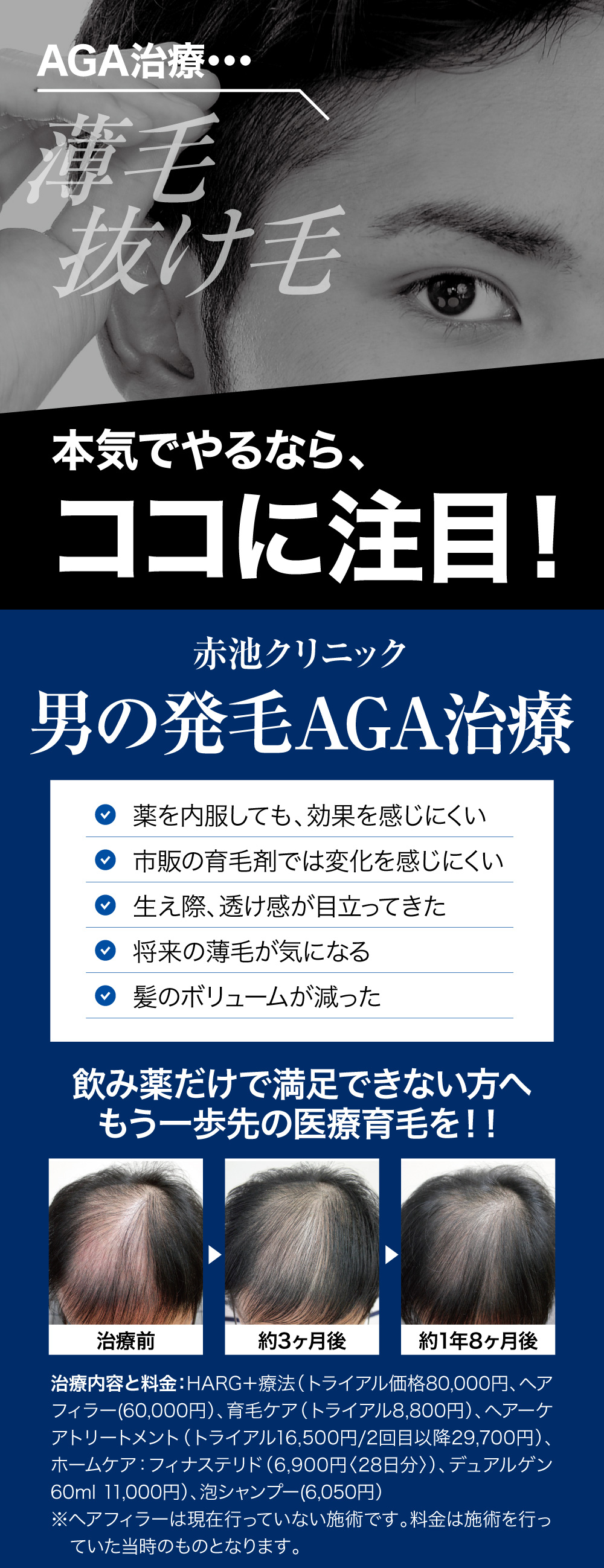 徳島で男性のAGA・薄毛治療｜赤池クリニックのHARG+療法と発毛・育毛治療