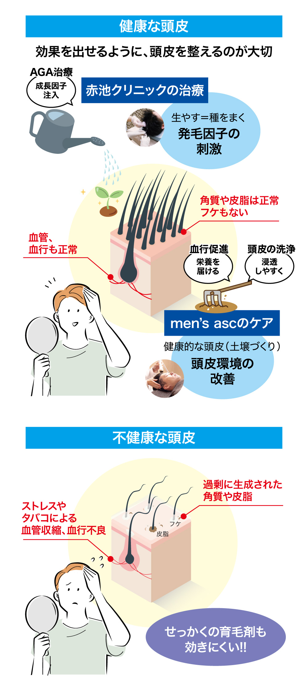 AGA・薄毛治療で頭皮環境を整える仕組み｜HARG+療法と頭皮ケア